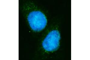 anti-Eukaryotic Translation Initiation Factor 4A1 (EIF4A1) (N-Term) antibody