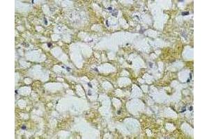 Immunohistochemistry (IHC) image for anti-Synaptophysin (SYP) antibody (ABIN1109181) (Synaptophysin Antikörper)