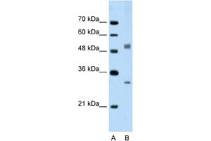 WB Suggested Anti-IRF6 Antibody Titration:  2. (IRF6 Antikörper  (C-Term))