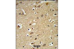 Immunohistochemistry (IHC) image for anti-Insulin-Like Growth Factor 1 (IGF1) (AA 51-77), (N-Term) antibody (ABIN5534411)