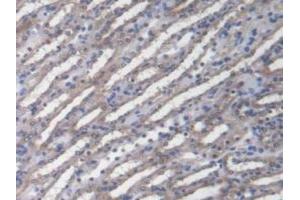 Immunohistochemistry (IHC) image for anti-DnaJ (Hsp40) Homolog, Subfamily C, Member 2 (DNAJC2) (AA 368-621) antibody (ABIN7444604)