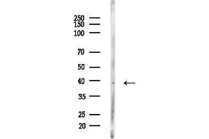 anti-Lysophosphatidic Acid Receptor 6 (LPAR6) (Internal Region) antibody