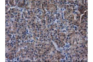 Immunohistochemical staining of paraffin-embedded Human pancreas tissue using anti-DSTN mouse monoclonal antibody. (Destrin Antikörper)