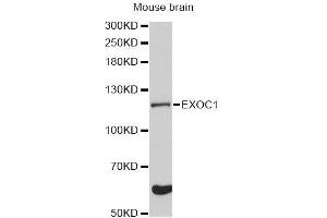 Western blot analysis of extracts of mouse brain, using EXOC1 Antibody (ABIN5996713) at 1:3000 dilution. (EXOC1 Antikörper)