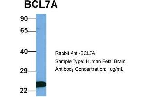 Host: Rabbit  Target Name: BCL7A  Sample Tissue: Human Fetal Brain  Antibody Dilution: 1.