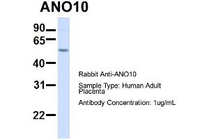Host:  Rabbit  Target Name:  ANO10  Sample Type:  Human Adult Placenta  Antibody Dilution:  1.