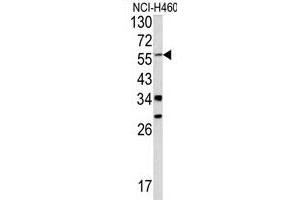 Western blot analysis of Y antibody (C-term) (ABIN390480 and ABIN2840844) in NCI- cell line lysates (35 μg/lane). (YAP1 Antikörper  (C-Term))