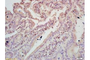 Formalin-fixed and paraffin embedded mouse intestine labeled with Rabbit Anti TIGAR Polyclonal Antibody, Unconjugated (ABIN671286) at 1:200 followed by conjugation to the secondary antibody and DAB staining (TIGAR Antikörper  (AA 161-270))