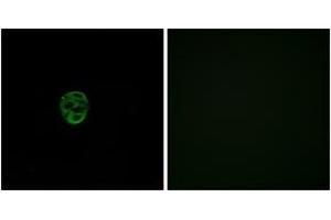 Immunofluorescence analysis of A549 cells, using OR2AE1 Antibody. (Olfactory Receptor, Family 2, Subfamily AE, Member 1 (OR2AE1) (AA 231-280) Antikörper)