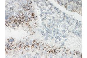 Image no. 3 for anti-Chemokine (C-X-C Motif) Ligand 1 (Melanoma Growth Stimulating Activity, Alpha) (CXCL1) antibody (ABIN464980) (CXCL1 Antikörper)