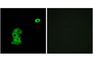 Immunofluorescence analysis of A549 cells, using OR4C6 Antibody.
