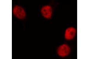 ABIN6268834 staining HeLa cells by IF/ICC. (DUSP1 Antikörper  (C-Term))