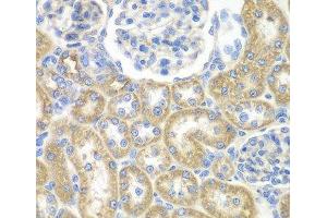 Immunohistochemistry of paraffin-embedded Rat kidney using GNAI2 Polyclonal Antibody at dilution of 1:100 (40x lens).