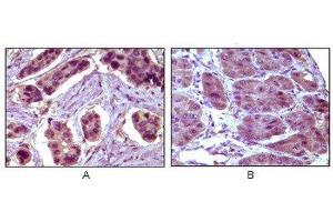 Immunohistochemistry (IHC) image for anti-B-Cell CLL/lymphoma 10 (BCL10) antibody (ABIN1842926) (BCL10 Antikörper)