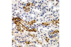 Immunohistochemistry of paraffin-embedded rat kidney using MT2A antibody at dilution of 1:200 (400x lens). (MT2A Antikörper)