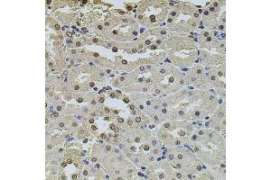 Immunohistochemistry of paraffin-embedded rat kidney using POT1 antibody (ABIN5970699) at dilution of 1/100 (40x lens). (POT1 Antikörper)
