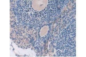 IHC-P analysis of Mouse Ovary Tissue, with DAB staining. (SERPING1 Antikörper  (AA 397-495))