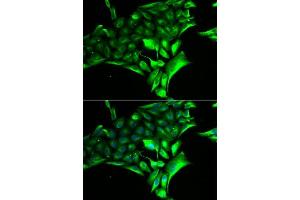 Immunofluorescence analysis of MCF-7 cells using PYGB antibody. (PYGB Antikörper  (AA 544-843))