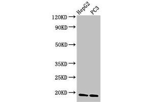 Western Blot Positive WB detected in: HepG2 whole cell lysate, PC-3 whole cell lysate All lanes: CAV2 antibody at 3 μg/mL Secondary Goat polyclonal to rabbit IgG at 1/50000 dilution Predicted band size: 19, 17, 13 kDa Observed band size: 19 kDa (Caveolin 2 Antikörper  (AA 3-64))