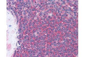 Anti-LCK antibody IHC of human spleen.