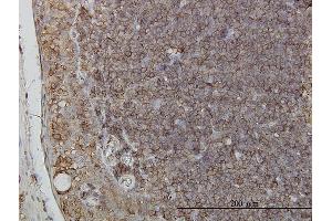 Immunostaining (ISt) image for anti-Ring Finger Protein 139 (RNF139) (AA 565-664) antibody (ABIN564887)