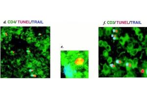Immunofluorescent analysis for death-inducing ligands and their receptors in spleens from HIV-1-infected hu-PBL-NOD-SCID mice.