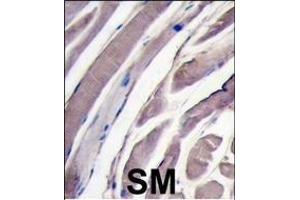 Formalin-fixed and paraffin-embedded human skeletal muscle tissue reacted with HK2 antibody (N-term), which was peroxidase-conjugated to the secondary antibody, followed by DAB staining.