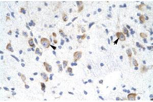 Rabbit Anti-GTF2F2 Antibody Catalog Number: ARP31437 Paraffin Embedded Tissue: Human Brain Cellular Data: Neural Cells Antibody Concentration: 4. (GTF2F2 Antikörper  (Middle Region))