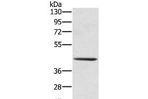 Western Blot analysis of 231 cell using SCPEP1 Polyclonal Antibody at dilution of 1:300 (SCPEP1 Antikörper)