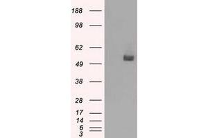 Western Blotting (WB) image for anti-CD36 (CD36) antibody (ABIN1497274) (CD36 Antikörper)