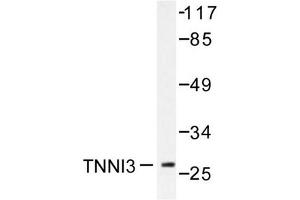 Image no. 1 for anti-Cardiac Troponin I (TNNI3) antibody (ABIN271938) (TNNI3 Antikörper)