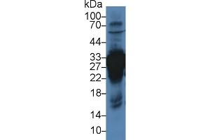 Western blot analysis of Rat Liver lysate, using Rat CA3 Antibody (3 µg/ml) and HRP-conjugated Goat Anti-Rabbit antibody ( (CA3 Antikörper  (AA 27-217))