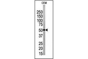 APG4B / ATG4B Antibody used in Western blot to detect APG4B in CEM tissue lysate. (ATG4B Antikörper  (N-Term))