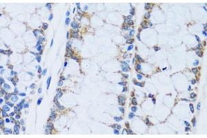 Immunohistochemistry of paraffin-embedded Human colon using CA13 Polyclonal Antibody at dilution of 1:100 (40x lens).