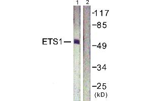 Immunohistochemistry analysis of paraffin-embedded human lung carcinoma tissue using ETS1 (Ab-38) antibody.