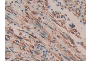 Immunohistochemistry (IHC) image for anti-Mechanistic Target of Rapamycin (serine/threonine Kinase) (mTOR) (AA 2226-2488) antibody (ABIN7440680)