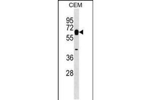 Western blot analysis in CEM cell line lysates (35ug/lane). (Myotilin Antikörper  (AA 127-155))