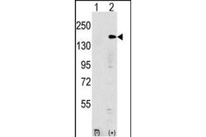 Western blot analysis of EHMT1 (arrow) using rabbit polyclonal EHMT1 Antibody (N-term) (ABIN387854 and ABIN2844016). (EHMT1 Antikörper  (N-Term))