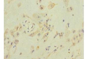 Immunohistochemistry of paraffin-embedded human placenta tissue using ABIN7176632 at dilution of 1:100
