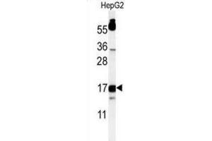 Western Blotting (WB) image for anti-TYRO Protein tyrosine Kinase Binding Protein (TYROBP) antibody (ABIN3004353)