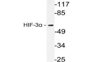 Western blot analysis of HIF3A Antibody in extracts from Rat brain cells. (HIF3A Antikörper)