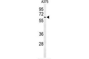 ALG10 Antikörper  (N-Term)