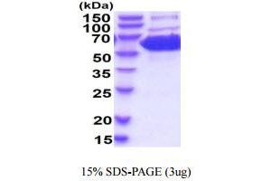 SDS-PAGE (SDS) image for Pyruvate Kinase M1/2 (PKM) (AA 1-531) (Active) protein (His tag) (ABIN6388051) (PKM Protein (AA 1-531) (His tag))