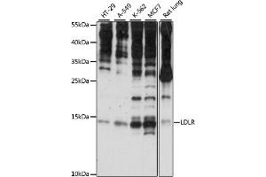 Western blot analysis of extracts of various cell lines, using SNRNP25 antibody (ABIN7270360) at 1:1000 dilution. (SNRNP25 Antikörper  (AA 1-132))