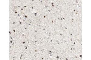 ABIN6267035 at 1/100 staining human Brain tissue sections by IHC-P. (CBP Antikörper  (C-Term))
