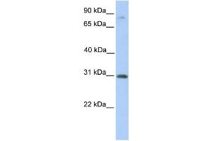 Western Blotting (WB) image for anti-Abhydrolase Domain Containing 13 (ABHD13) antibody (ABIN2459363) (ABHD13 Antikörper)