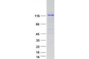 Validation with Western Blot (APP Protein (Transcript Variant 2) (Myc-DYKDDDDK Tag))