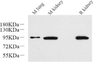 Western Blot analysis of various samples using Catenin beta Monoclonal Antibody at dilution of 1:1000. (beta Catenin Antikörper)