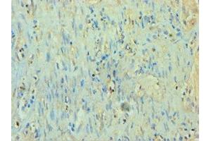 Immunohistochemistry of paraffin-embedded human epityphlon tissue using ABIN7166926 at dilution of 1:100