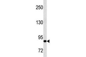 Western Blotting (WB) image for anti-Matrix Metallopeptidase 9 (Gelatinase B, 92kDa Gelatinase, 92kDa Type IV Collagenase) (MMP9) antibody (ABIN3031727)